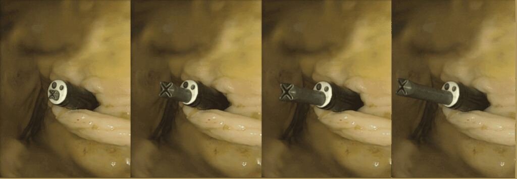 Pressure-free growing robots for soft medical robotics