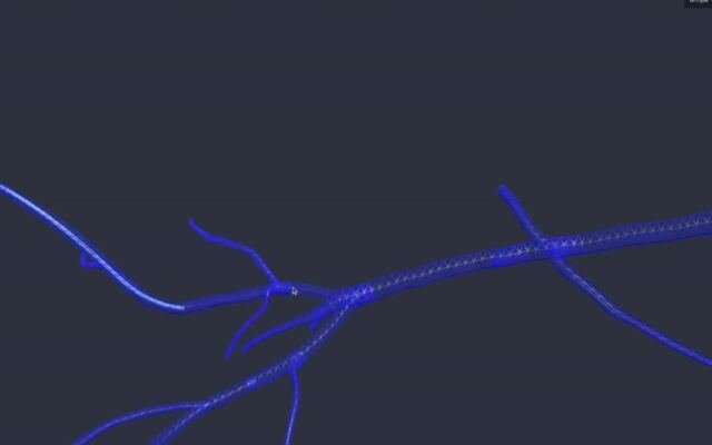 NVIDIA Open Sources First GPU-Accelerated Medical Physics Simulation Framework